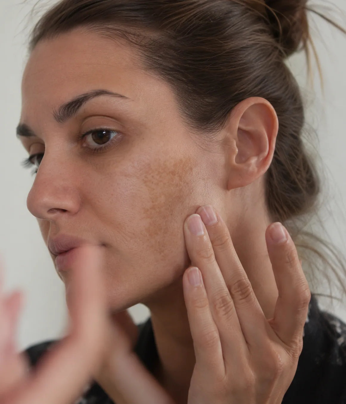 Woman with natural freckles gently touching her cheek